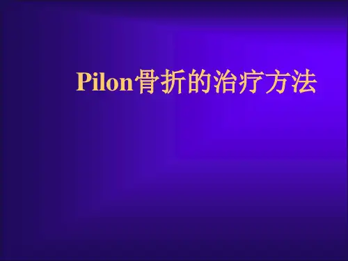 Pilon骨折的治疗