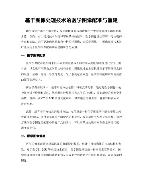 基于图像处理技术的医学图像配准与重建