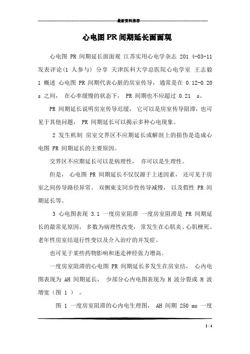 心电图PR间期延长面面观