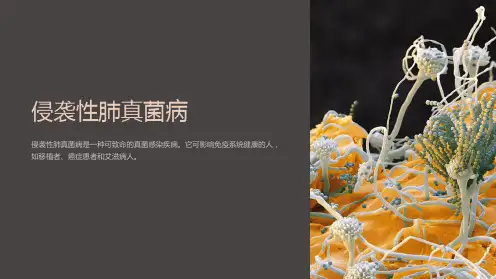《侵袭性肺真菌病》课件