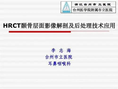 HRCT颞骨层面影像解剖及后处理技术应用