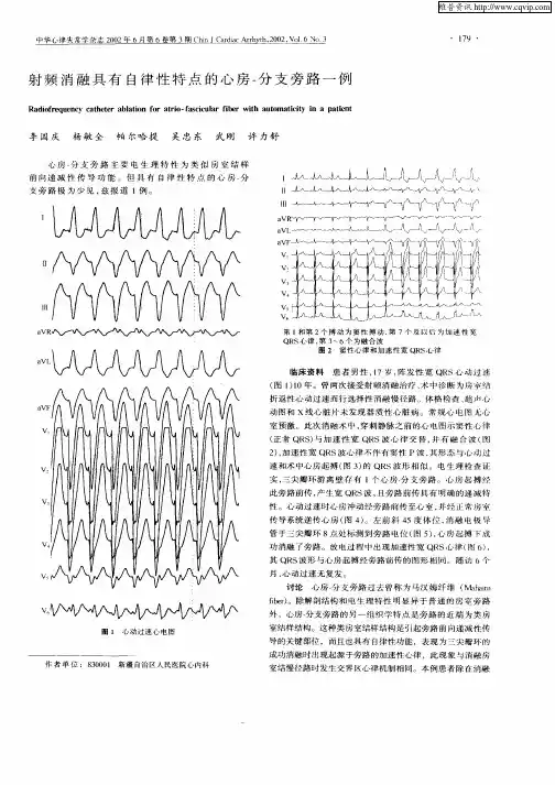 射频消融具有自律性特点的心房—分支旁路一例