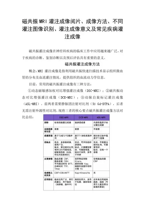 磁共振MRI灌注成像阅片、成像方法、不同灌注图像识别、灌注成像意义及常见疾病灌注成像