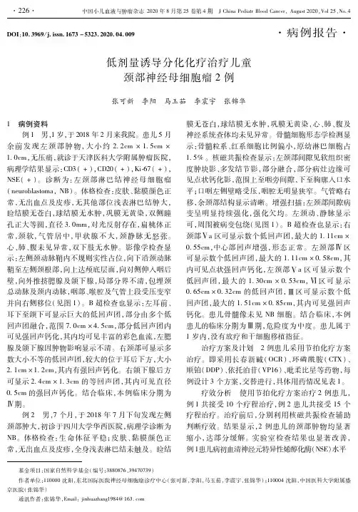 低剂量诱导分化化疗治疗儿童颈部神经母细胞瘤2例