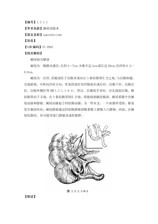 阑尾切除术