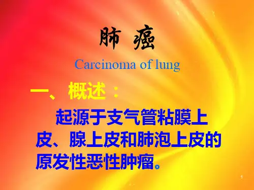 肺癌 ppt课件