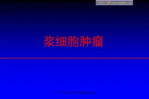 浆细胞肿瘤