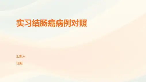 实习结肠癌病例对照