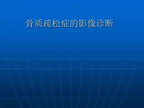 骨质疏松症的影像诊断