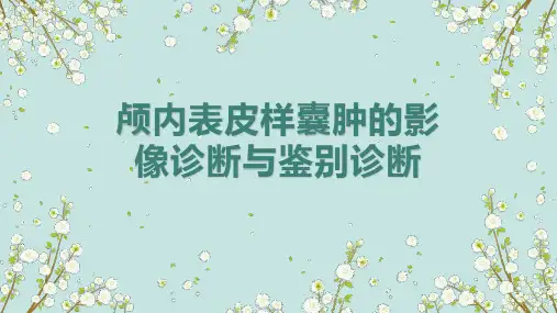 颅内表皮样囊肿的影像诊断与鉴别诊断
