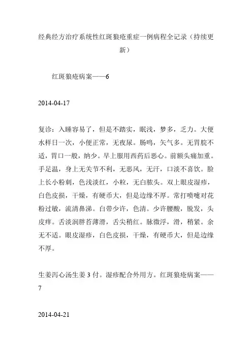 经典经方治疗系统性红斑狼疮重症一例病程全记录(持续更新)