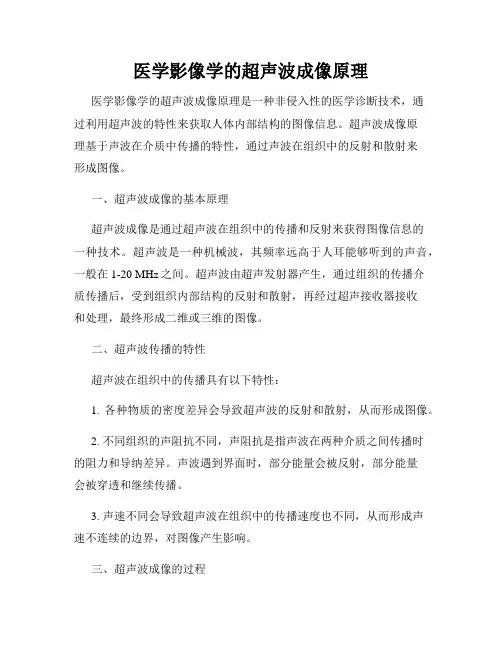 医学影像学的超声波成像原理