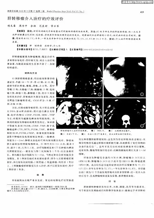 肝转移瘤介入治疗的疗效评价