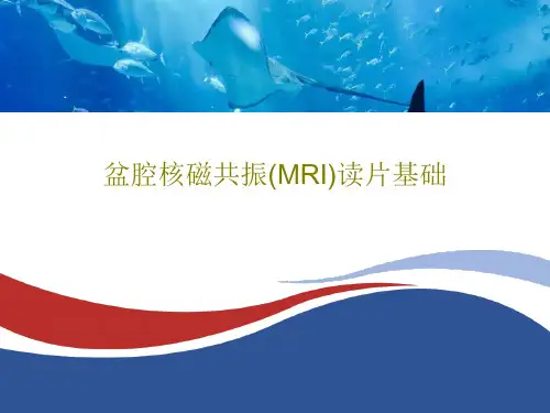 盆腔核磁共振(MRI)读片基础73页PPT