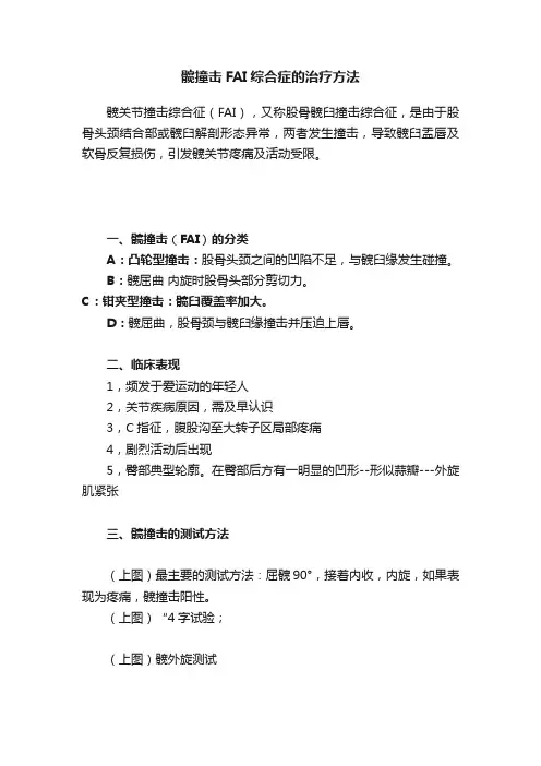 髋撞击FAI综合症的治疗方法