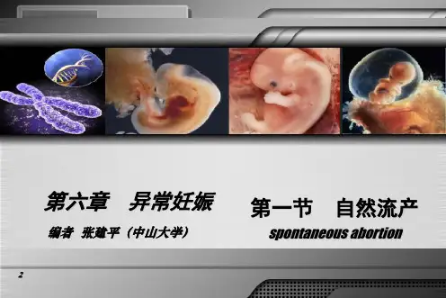 妇产科学第八版配套自然流产PPT课件