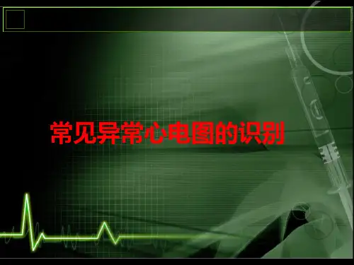 常见异常心电图的识别fPPT课件