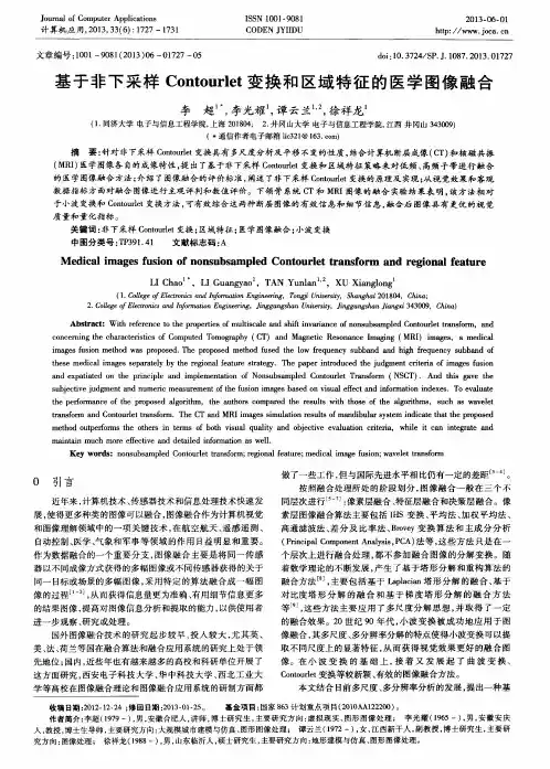基于非下采样Contourlet变换和区域特征的医学图像融合