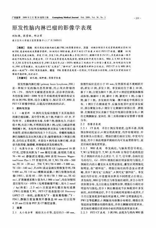 原发性脑内淋巴瘤的影像学表现