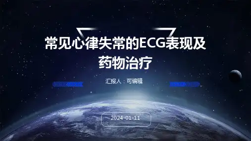 常见心律失常的ECG表现及药物治疗医学PPT