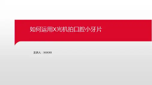 如何运用X光机拍口腔小牙片