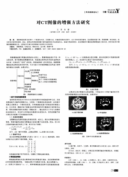 对CT图像的增强方法研究