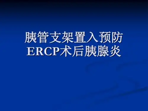 胰管支架置入预防ERCP术后胰腺炎