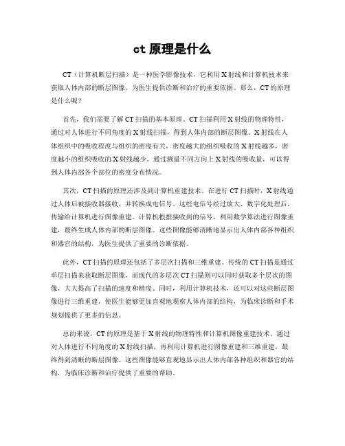 ct原理是什么