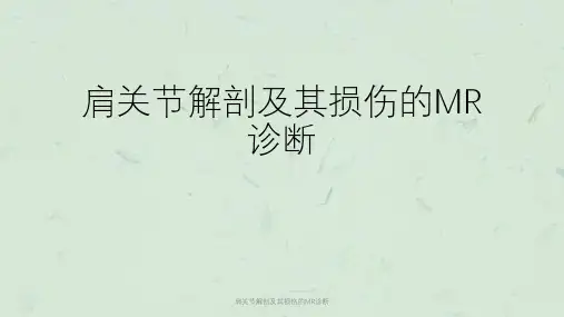 肩关节解剖及其损伤的MR诊断课件