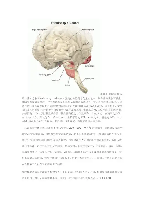 垂体危象