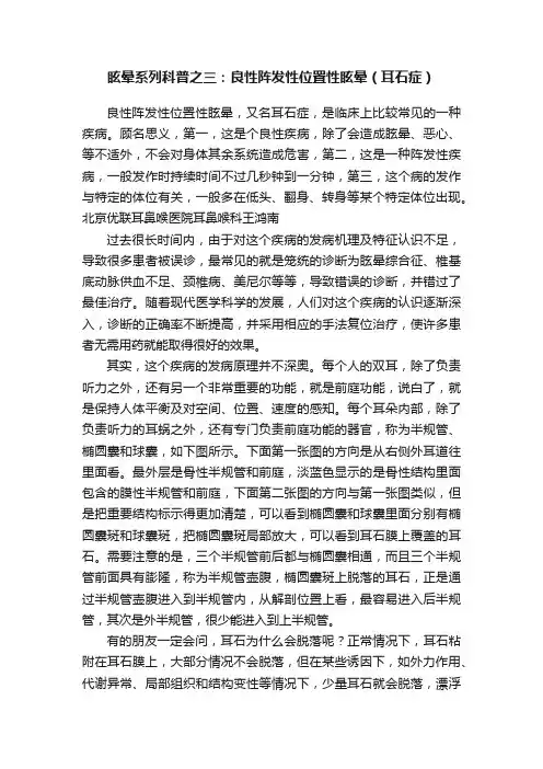眩晕系列科普之三：良性阵发性位置性眩晕（耳石症）
