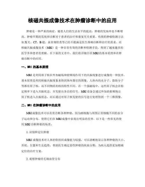核磁共振成像技术在肿瘤诊断中的应用