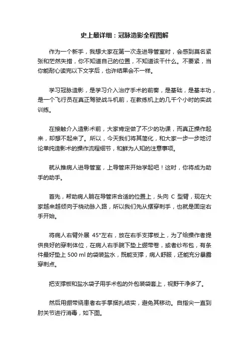 史上最详细：冠脉造影全程图解