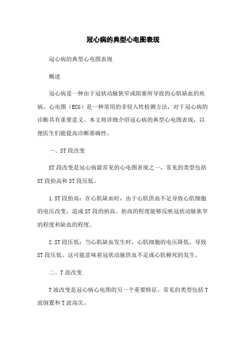 冠心病的典型心电图表现