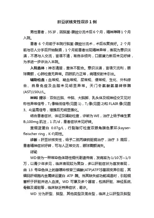 肝豆状核变性误诊1例