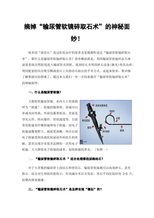 摘掉“输尿管软镜碎取石术”的神秘面纱！