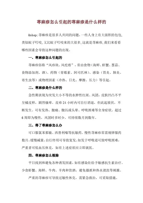 荨麻疹怎么引起的 荨麻疹是什么样的
