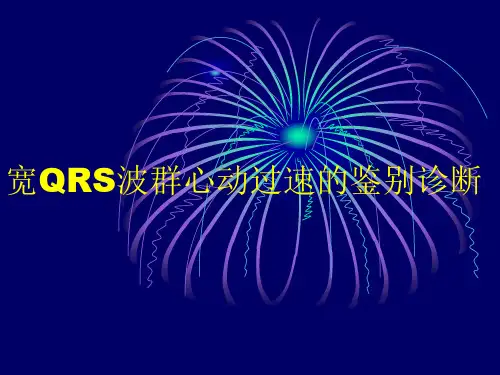 宽QRS波群心动过速的鉴别诊断