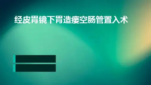 经皮胃镜下胃造瘘空肠管置入术