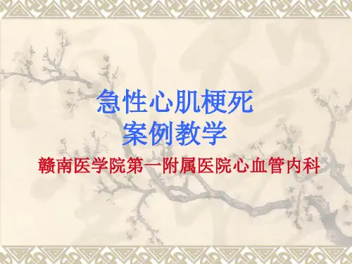 急性心肌梗死案例教学PPT课件