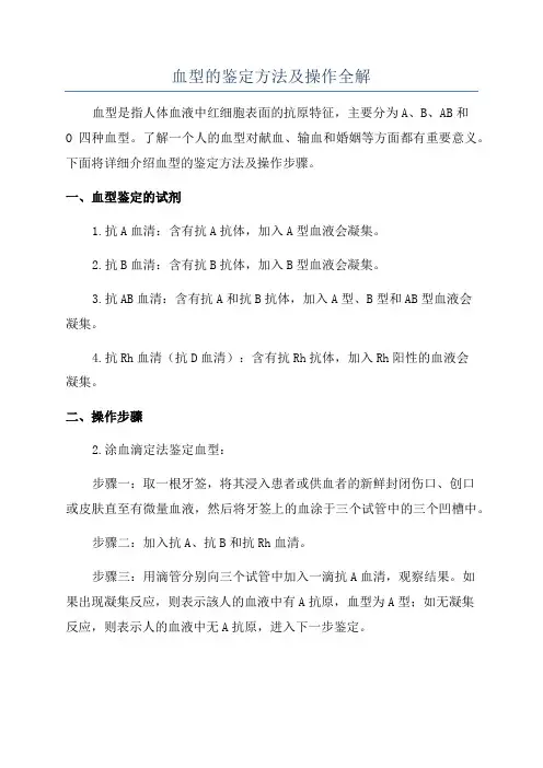 血型的鉴定方法及操作全解