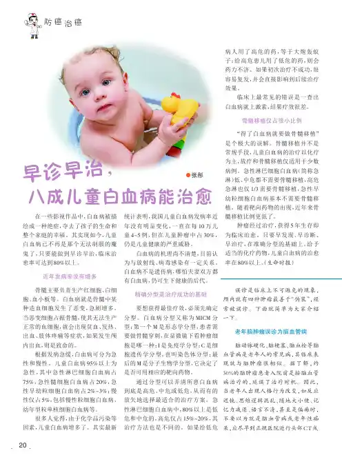 四种最善于“伪装”的脑肿瘤