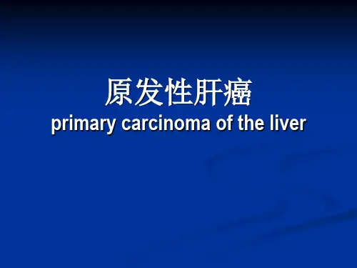 原发性肝癌ppt医学课件