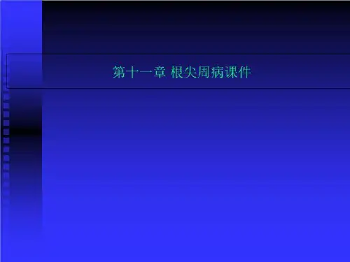 第十一章 根尖周病课件