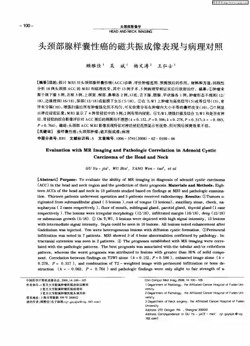 头颈部腺样囊性癌的磁共振成像表现与病理对照