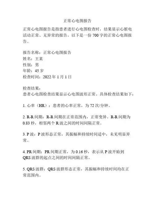 正常心电图报告