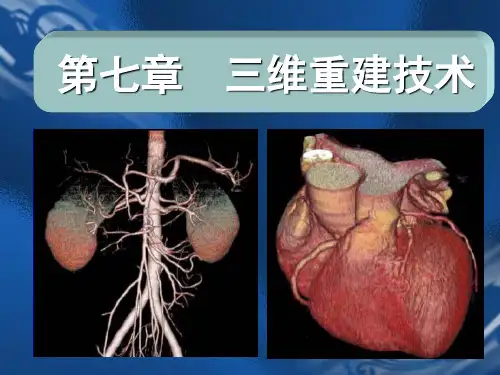 医学成像技术(三维重建技术)课件