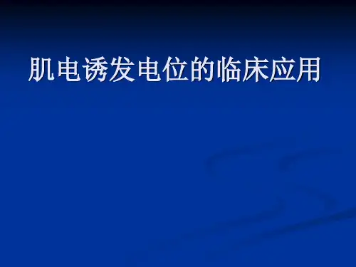 肌电诱发电位的临床应用