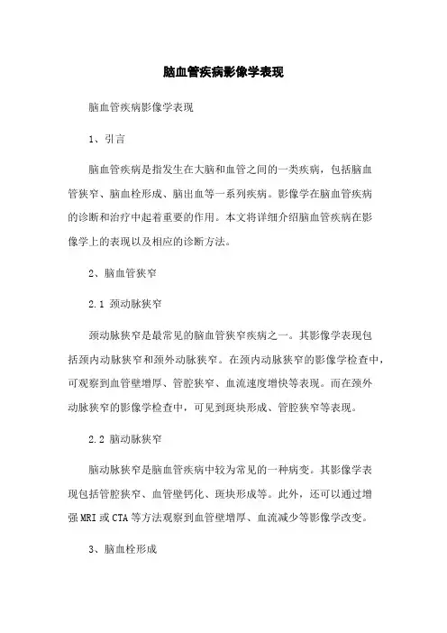 脑血管疾病影像学表现