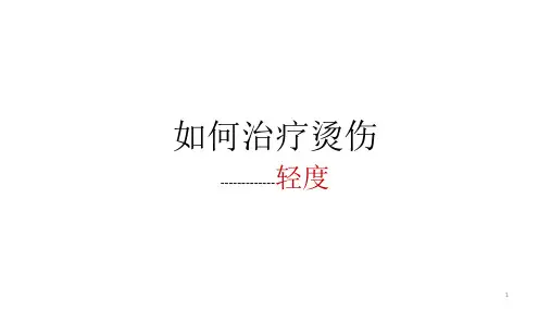 如何处理烫伤ppt课件